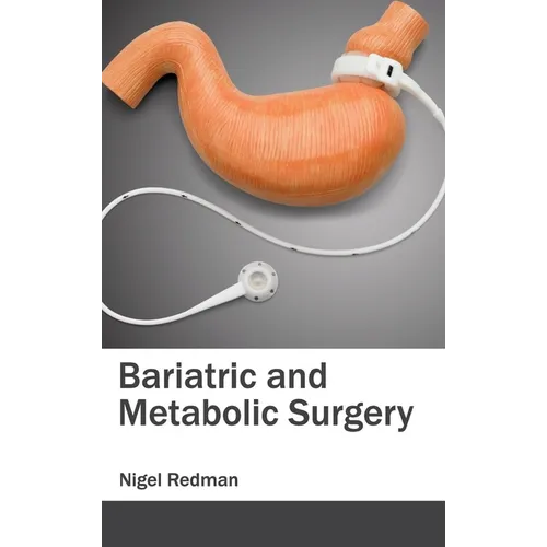 Bariatric and Metabolic Surgery
