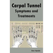 Carpal Tunnel Symptoms and Treatments: All about Carpal Tunnel Syndrome Causes, Diagnosing, Symptoms, Signs, Non-Surgical and Surgical Treatments, Alt