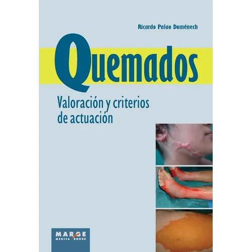 Quemados. Valoración y criterios de actuación