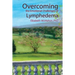 Overcoming the Emotional Challenges of Lymphedema