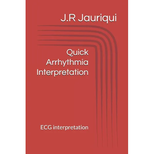 Quick Arrhythmia Interpretation: ECG interpretation
