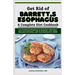 Get Rid of Barrett's Esophagus: A Complete Diet Cookbook: Your Nutritional Roadmap to Symptom Alleviation, Reduced Acid Reflux, and Total Healing from
