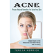 Acne: Proven Natural Remedies for Acne-free Skin (Learn About the Most Recent Updated Natural Acne)