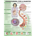 Understanding Type 2 Diabetes Anatomical Chart