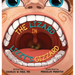 The Lizzard in Lizzy's Gizzard