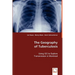 The Geography of Tuberculosis