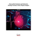 Myocardial Ischemia and Infarction During Coronary Artery Bypass Surgery
