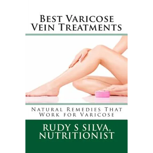 Best Varicose Vein Treatments: Natural Remedies That Work For Varicose