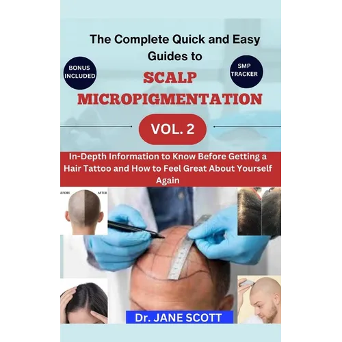 The Complete Quick and Easy Guides to SCALP MICROPIGMENTATION VOL. 2: In-Depth Information to Know Before Getting a Hair Tattoo and How to Feel Great