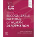 Smith's Recognizable Patterns of Human Deformation