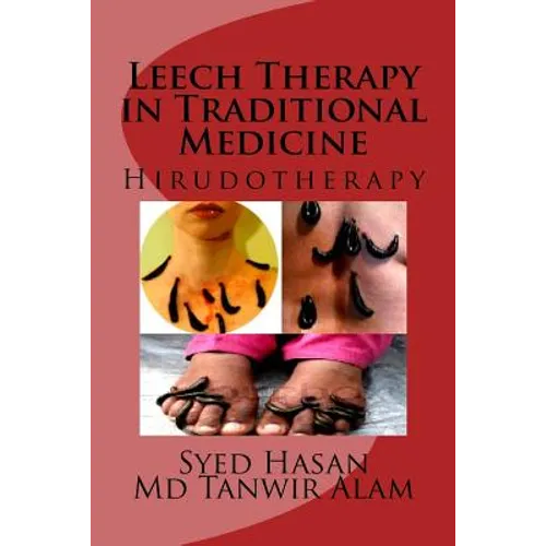 Leech Therapy in Traditional Medicine: Hirudotherapy