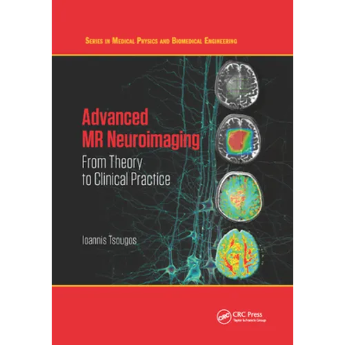 Advanced MR Neuroimaging: From Theory to Clinical Practice