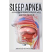 Sleep Apnea: A Profound Guide to Sleep Well and Feel Better