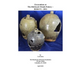 Excavations at 38AK172- The Hitchcock Woods Pottery- 2015