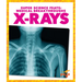 X-Rays