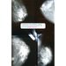 The Biopolitics of Breast Cancer: Changing Cultures of Disease and Activism