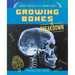 Growing Bones