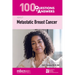 100 Questions & Answers about Metastatic Breast Cancer
